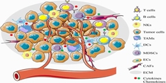 Immunometabolism in the Bladder Cancer Microenvironment 